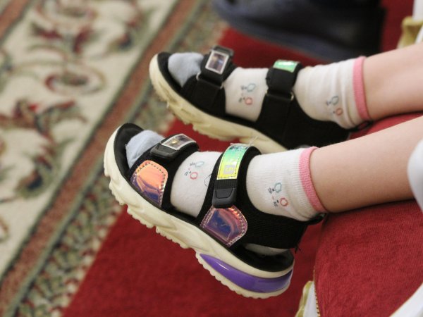 4-летняя бузулучанка получила сильные ожоги
