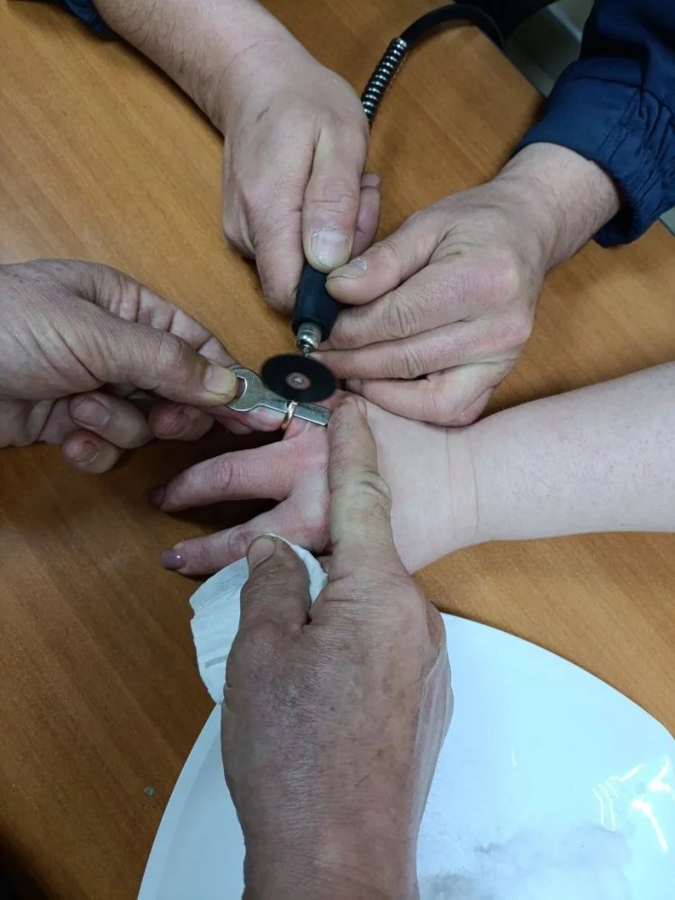 Спасатели снимают кольцо с распухшего пальца оренбурженки; фото: Департамент ПБ и ГЗ по Оренбургской области 