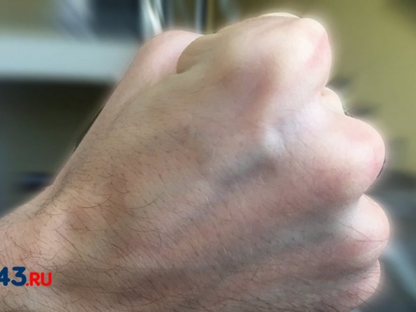 Простила избиение за кольцо и серьги: сожитель сломал ключицу своей любимой