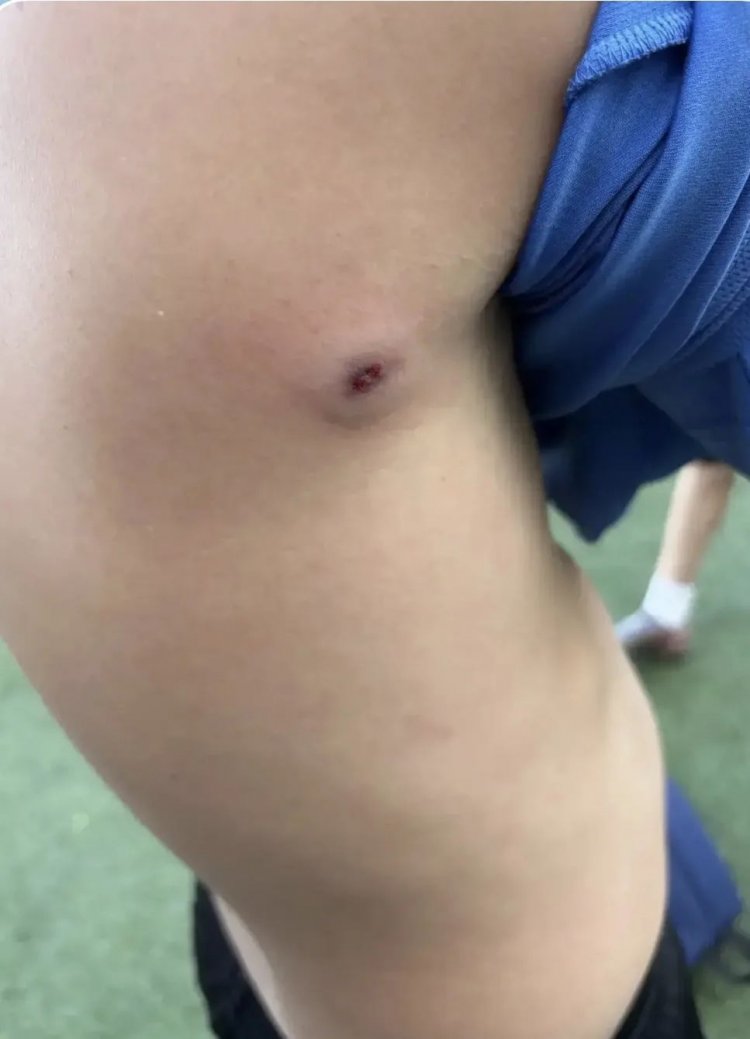 В оренбурге по детям стреляли из травмата В оренбурге по детям стреляли из травмата