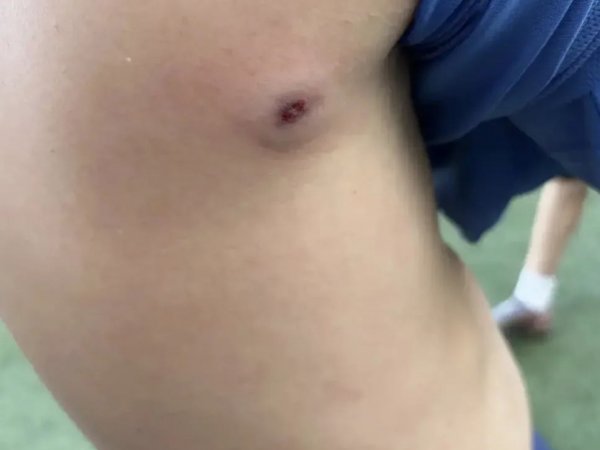 В оренбурге по детям стреляли из травмата